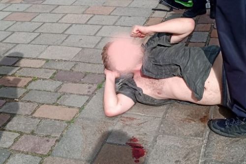 Foto: Chtěl napadnout městskou policistku, skončil s tržnou ránou na hlavě