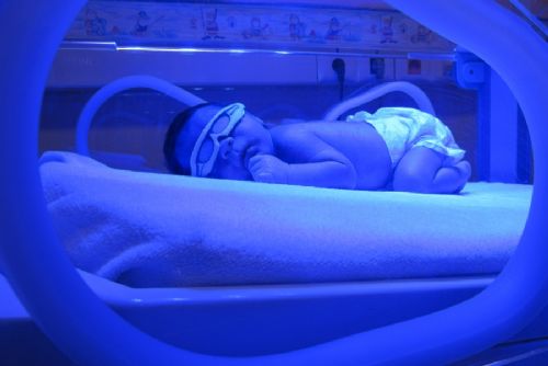 Foto: Stodská nemocnice léčí novorozeneckou žloutenku modrým světlem