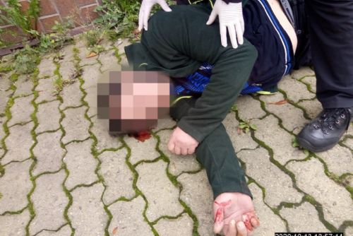 Foto: U podchodu v Plzni na Americké ležel zraněný muž