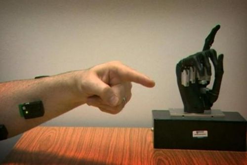Foto: Bionické ruce - mechanický stroj je pro své nositele požehnáním