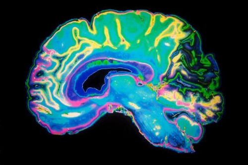 Foto: Čeští vědci našli v mozku neurony emocí