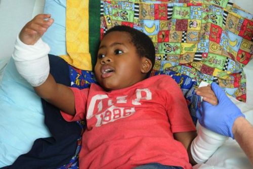 Foto: Osmiletý Zion dostal nové ruce - jako nejmladší pacient