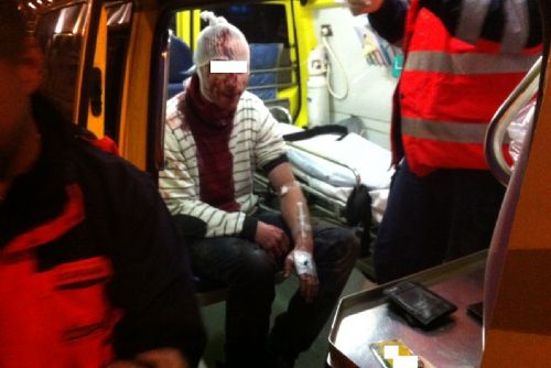 Foto: Plzeňák krvácel u divadla Alfa, pomohli mu strážníci