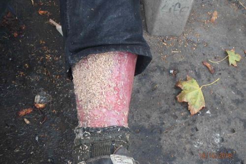 Foto: Bezdomovec u autobusáku v Plzni měl v nohách červy