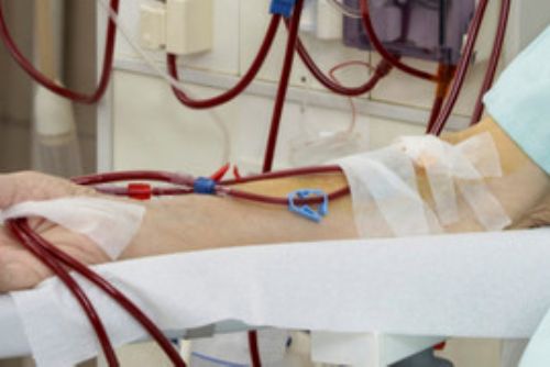Foto: Klatovská a Stodská nemocnice vyšetří zdarma ledviny