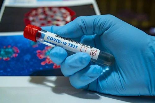 Foto: Covid v kraji ustupuje, očkování v Prioru v pátek končí
