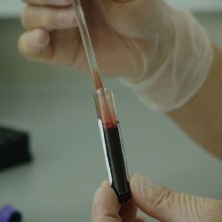 Lidi ohrožené virem HIV může ochránit speciální lék
