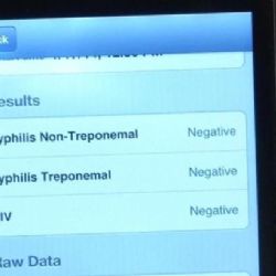 HIV, malárii nebo syfilis pomůže odhalit chytrý telefon
