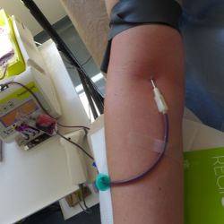 Transfuzní oddělení FN Plzeň se opět potýká s nedostatkem dárců krve