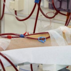 Plzeňské dialyzační středisko je na pacienty s covidem připraveno
